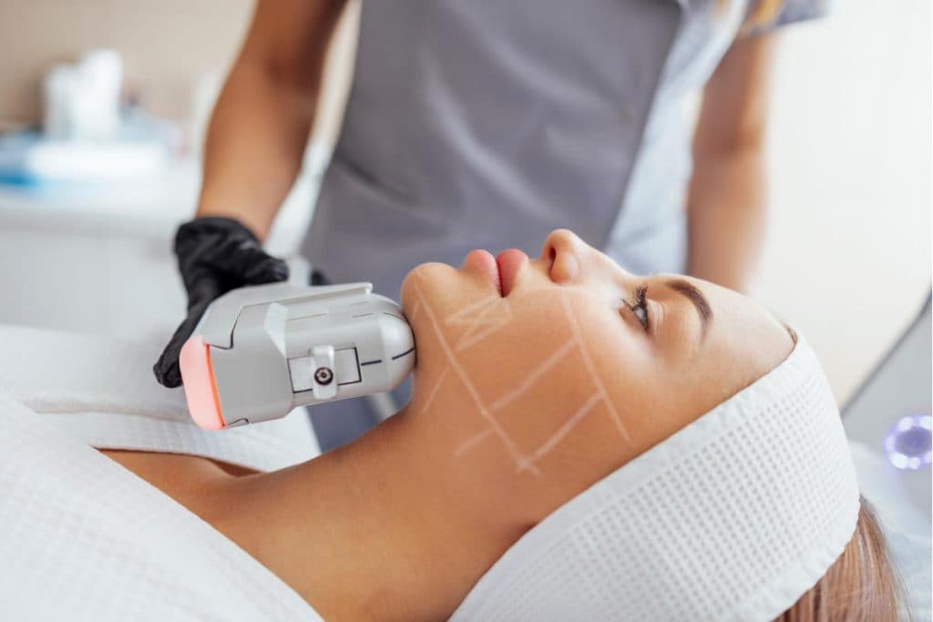 HIFU face and body lifting treatment at Calyx Skin Lab